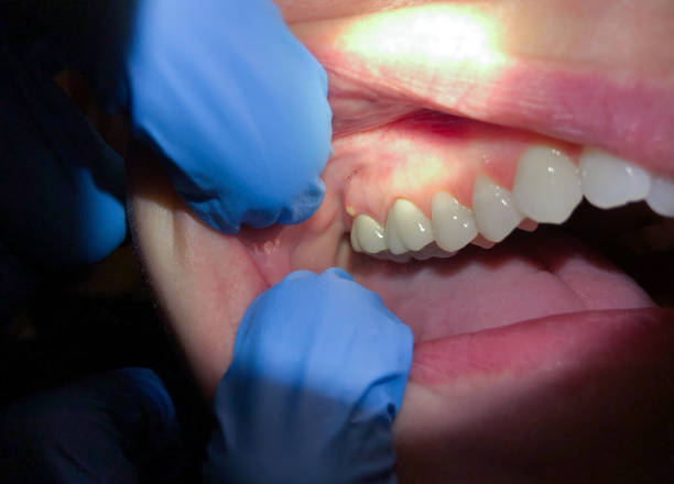 Best Teeth Whitening  in Farrell, PA